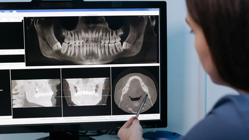 ISEIE, odontologia digital, odontología digital, curso odontologia digital, curso de odontologia digital, cursos odontologia digital, odontología digital cursos, odontologia, odontología, que es odontologia, odontología que es, odontología que es, odontologia carrera, odontologia carrera, odontologia carrera, facultad de odontologia, Máster Odontología Digital