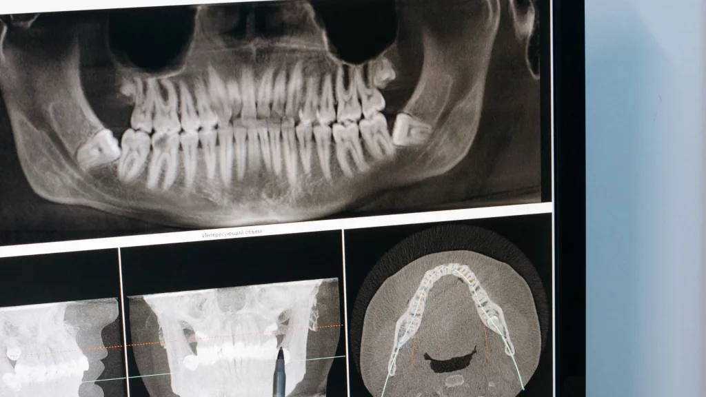 Fotografía Odontológica
