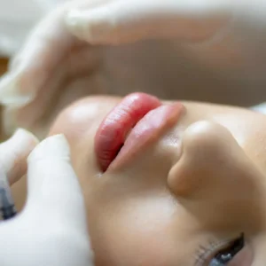 Curso de Medicina Estética 1