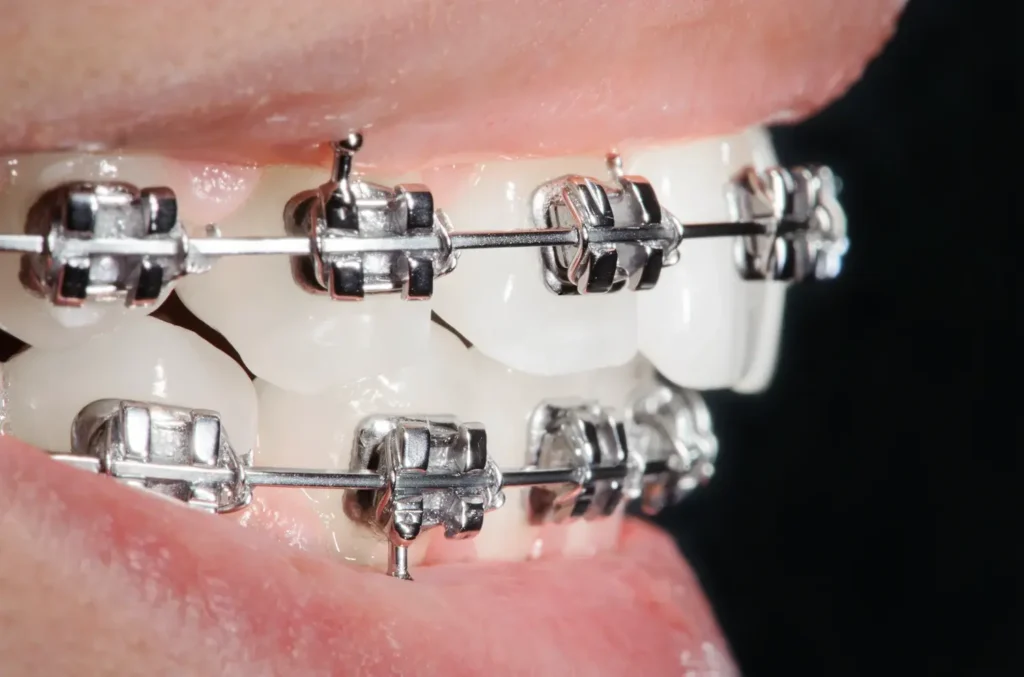 Maestría ortodoncia 2