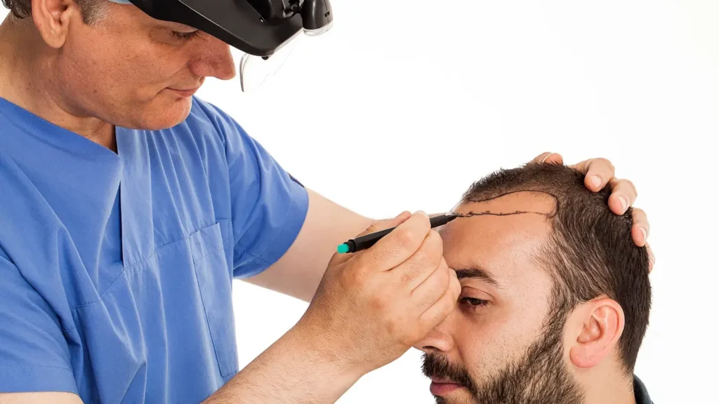 Maestría en Trasplante Capilar 2