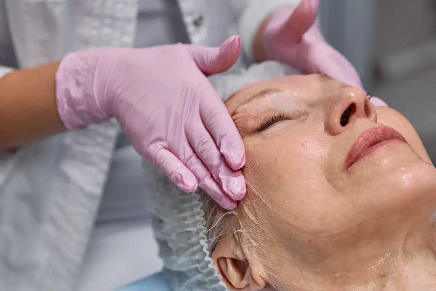 Maestría en Enfermería en Peelings, Microneedling y Procedimientos Dermoestéticos