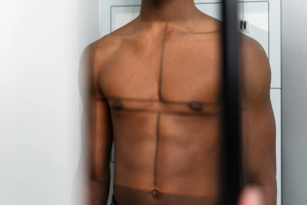 Maestría en Cirugía Estética Masculina Avanzada Abdomen Pectoral Brazos y Flancos 2