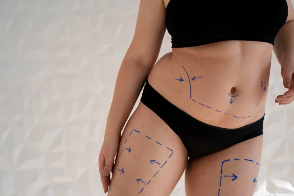 Maestría en Cirugía de Contorno Corporal Liposucción Lipo HD y Lipoescultura 1