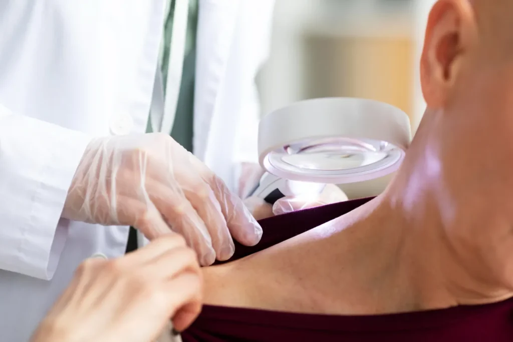 Maestría en Diagnóstico Dermatológico y Triaje de Lesiones Cutáneas 2