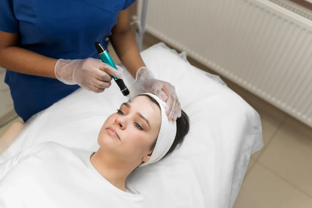 Maestría en Enfermería en Peelings Microneedling y Procedimientos Dermoestéticos 1
