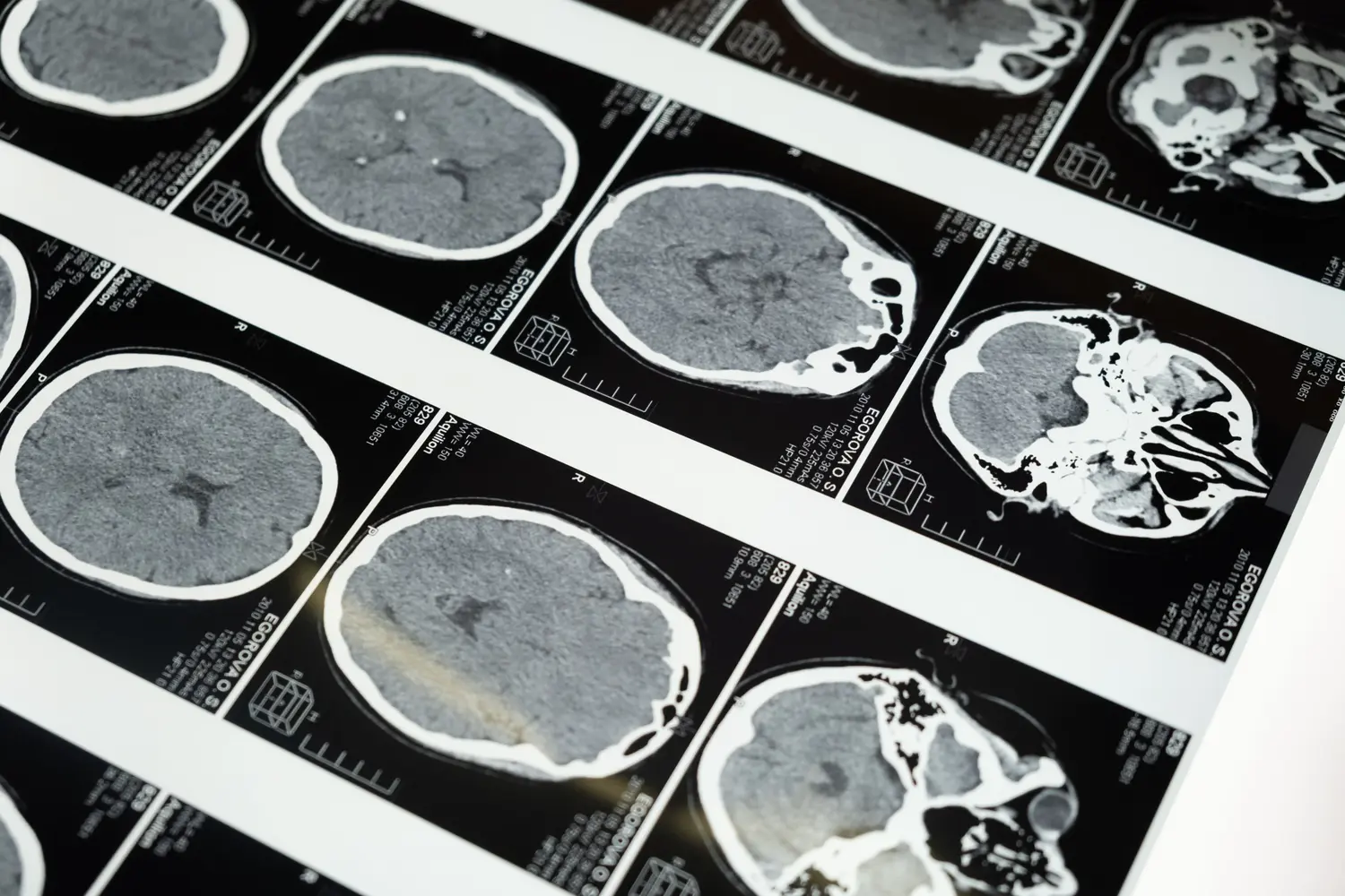 Maestría en Radiología y Técnicas de Imagen para el Diagnóstico Clínico