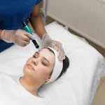 Maestría en Enfermería en Peelings Microneedling y Procedimientos Dermoestéticos 1