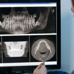 Maestría en Odontología Restauradora 1