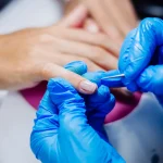 Maestría en Uñas Patología Estética y Reconstrucción 1